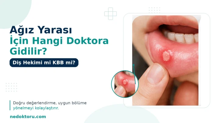 Ağız Yarası İçin Hangi Doktora Gidilir? Diş Hekimi mi KBB mi?