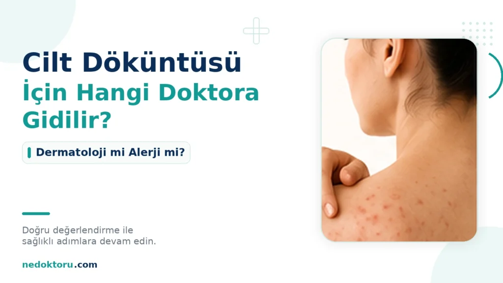 Cilt Döküntüsü İçin Hangi Doktora Gidilir? Dermatoloji mi Alerji mi?