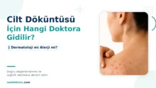 Cilt Döküntüsü İçin Hangi Doktora Gidilir? Dermatoloji mi Alerji mi?