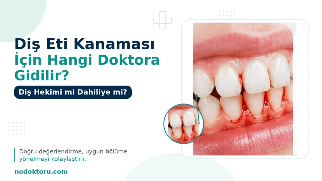 Diş Eti Kanaması İçin Hangi Doktora Gidilir? Diş Hekimi mi Dahiliye mi?