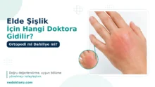 Elde Şişlik İçin Hangi Doktora Gidilir? Ortopedi mi Dahiliye mi?