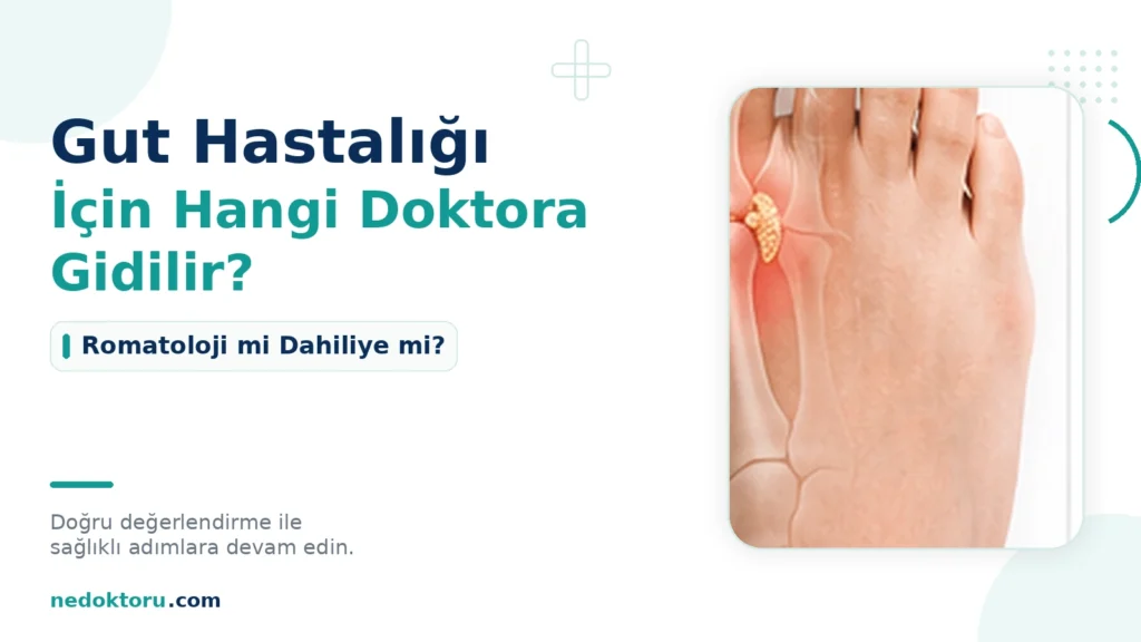 Gut Hastalığı İçin Hangi Doktora Gidilir? Romatoloji mi Dahiliye mi?